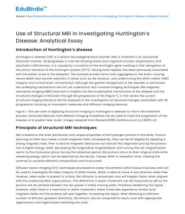 Structural MRI in Huntington’s Disease