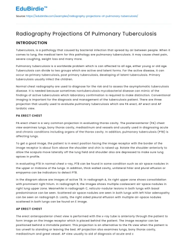 Radiography Projections Of Pulmonary Tuberculosis
