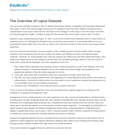 The Overview of Lupus Disease