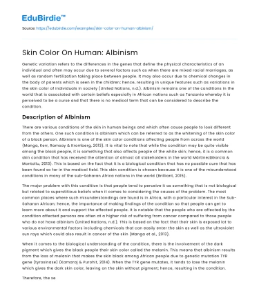 Skin Color On Human: Albinism