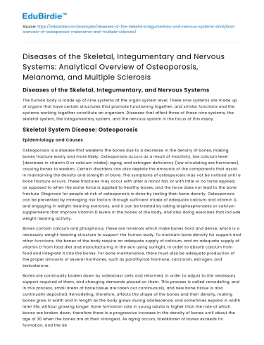 Overview of Osteoporosis, Melanoma, & Multiple Sclerosis
