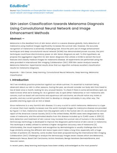 Skin Lesion Classification for Melanoma with CNN and Image Enhancement
