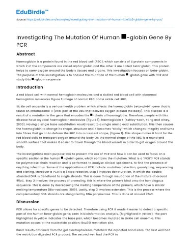 Investigating The Mutation Of Human Β-globin Gene By PCR
